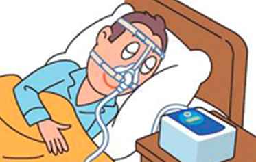 ②経鼻的持続陽圧呼吸療法（シーパップ（CPAP)療法）