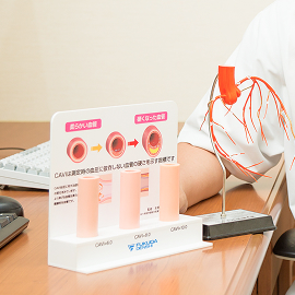 動脈や静脈の病気