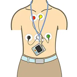 ホルター心電図